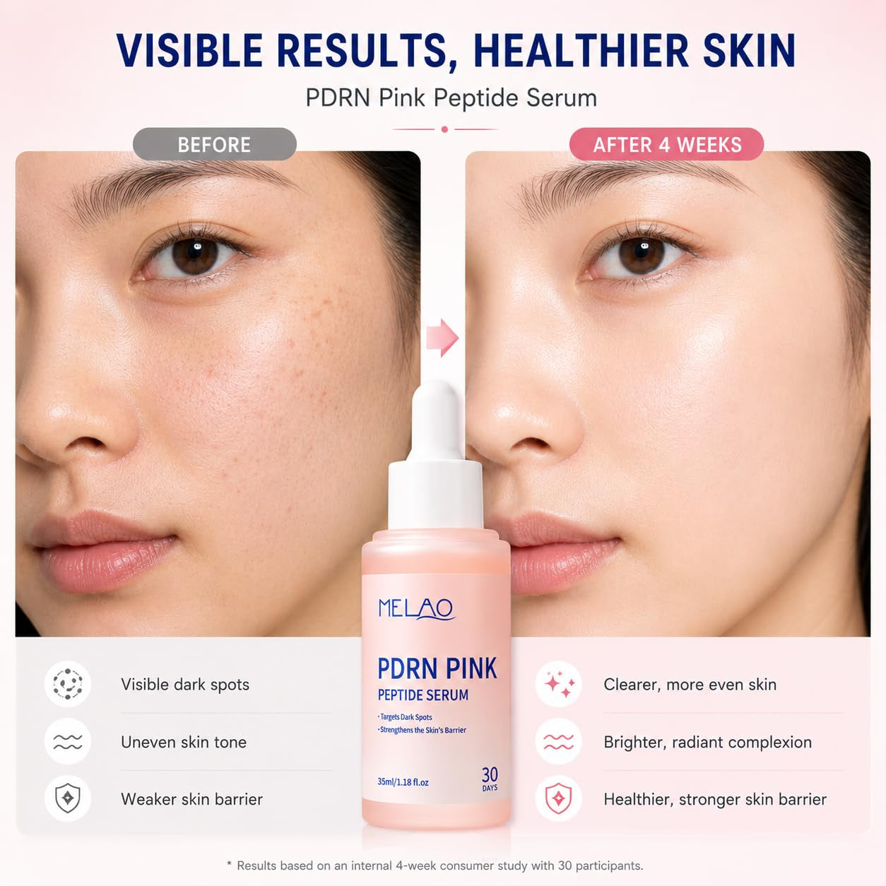PDRN Pink Peptide Serum with Salmon DNA | Pink Glow Serum with Peptides & Niacinamide for Hydration & Firm-Looking Skin