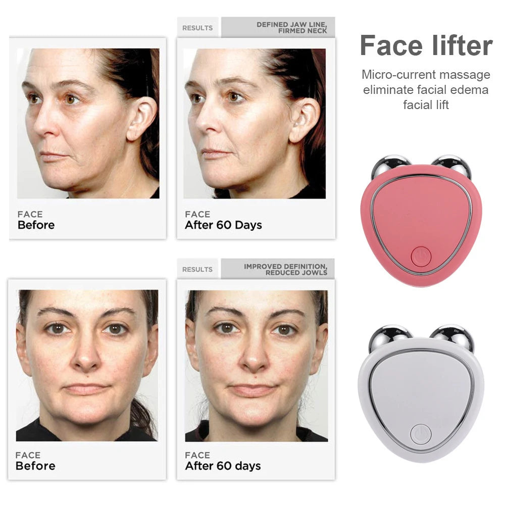 Revitalizing Cold Gel Microcurrent Face Lifter – Anti-Wrinkle Roller for Youthful, Tightened Skin