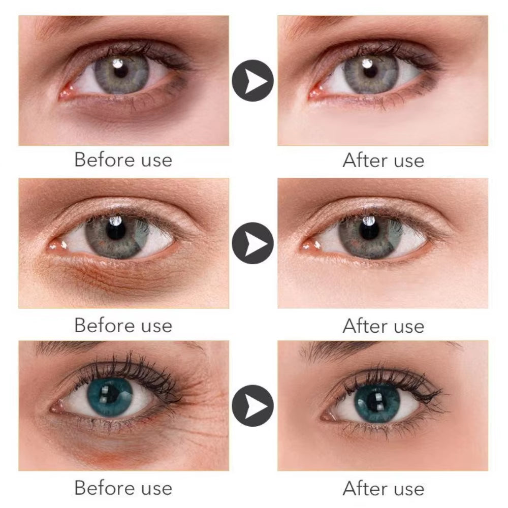 Revitalizing Gold Eye Serum - Retinol Anti-Aging & Whitening Formula for Flawless Skin