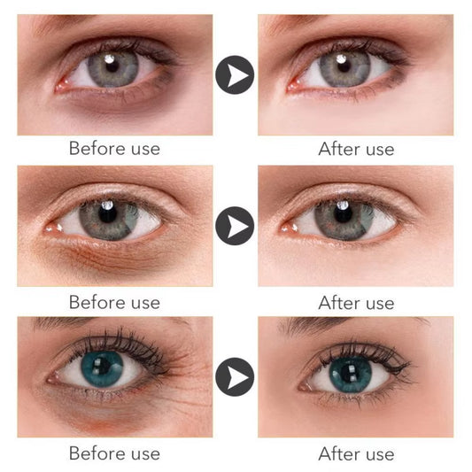 Revitalizing Gold Eye Serum - Retinol Anti-Aging & Whitening Formula for Flawless Skin